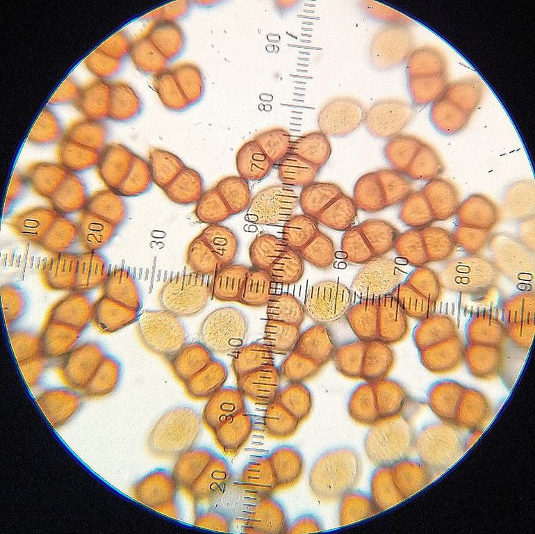 Microscopisch beeld van urediniosporen (de lichter gekleurde eencellige sporen) en teliosporen (de donkerder gekleurde tweecellige sporen)