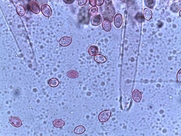 Microscopisch beeld van de sporen en lamelcystiden
