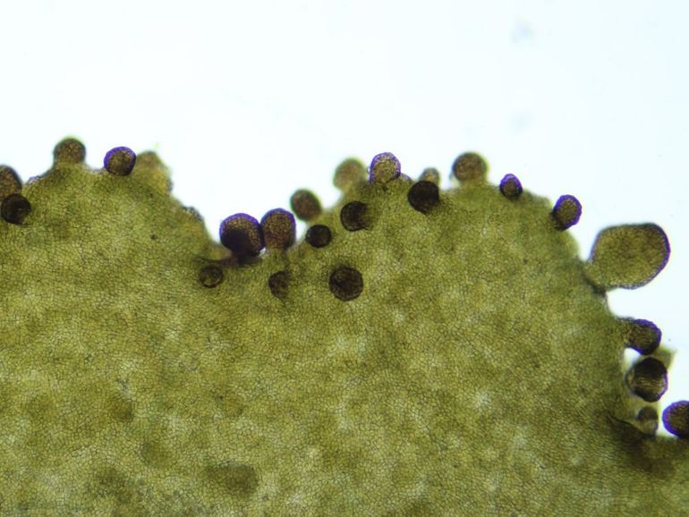 Schuursponszwelkorst onder de microscoop. De isidiën op de rand van de lobben en de netvormige structuur van het oppervlak zijn kenmerkend