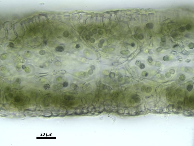 Schuursponszwelkorst onder de microscoop laat een sponsachtige structuur zien. De blauwalgen hebben een blauwgroene kern en leven in de structuur die de schimmel voor ze maakt