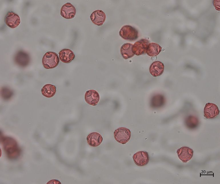Lichtmicroscoopfoto van aangekleurd Betula pendula (ruwe berk) pollen (400 keer vergroting)