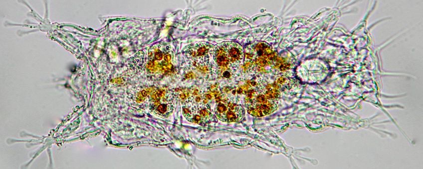 Microscopie foto van het nieuwe Nederlandse Beerdiertje Batillipes phraeticus, Katwijk aan Zee, april, 2014