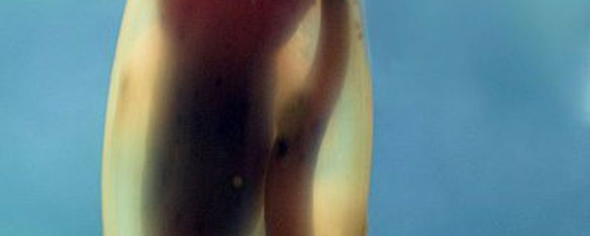 Eikapsel met embryo hondshaai, wikipedia, GNU Free Documentation License,