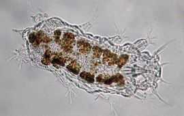 Microscopische opname van een Nederlands exemplaar van het Vulpenstekel strandbeerdiertje. De karakteristieke stekel bij de staart is linksboven in de foto te zien