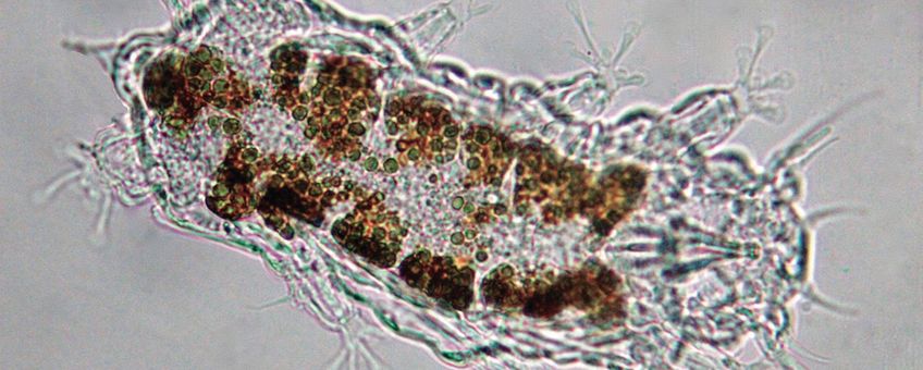 Microscopische opname van een Nederlands exemplaar van het Vulpenstekel strandbeerdiertje. De karakteristieke stekel bij de staart is linksboven in de foto te zien