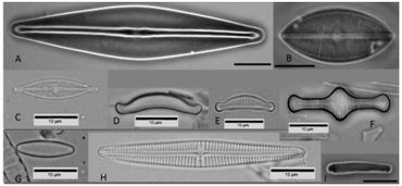 Kiezelwieren door de microscoop (de maatstreepjes zijn 0,01 millimeter). De zuurindicator Eunotia exigua is te zien op preparaat D