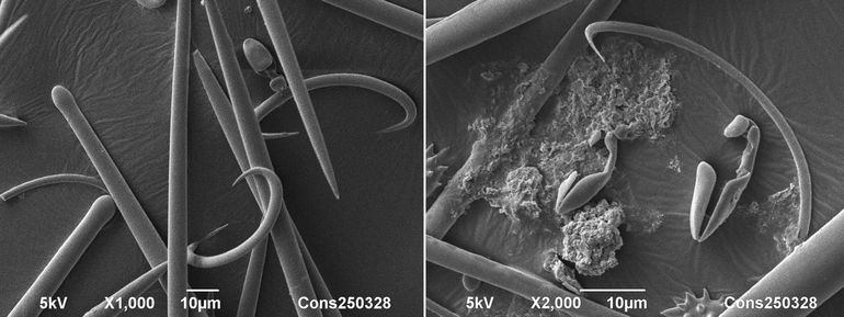 Sponsnaaldjes (spicula) van de Knobbelspons, bekeken met de elektronenmicroscoop. Links: subtylostylen (naaldvormig, aan &eacute;&eacute;n zijde een stompe knop), sigma's (C-vormig, met puntige einden) en anisochela (niet -symmetrische ankertjes). Rechts: anisochela en sigma-spicula, sterker vergroot