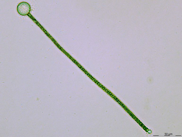 Deze draadvormige blauwalg (Planktothrix) wordt geparasiteerd door een schimmel: het bolletje aan het uiteinde