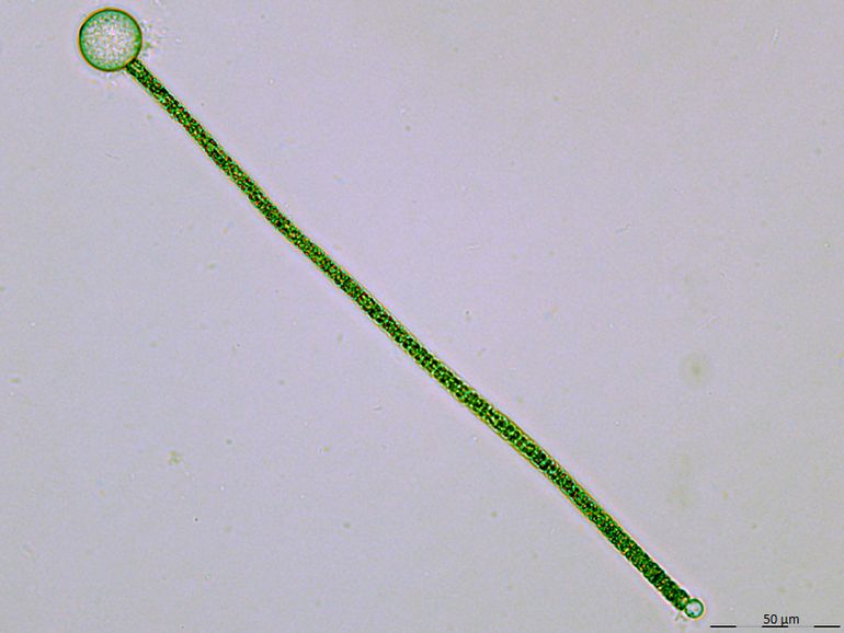 Deze draadvormige blauwalg (Planktothrix) wordt geparasiteerd door een schimmel: het bolletje aan het uiteinde