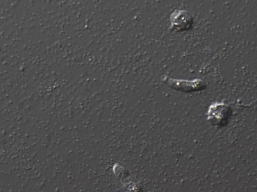 Protist Saccamoeba lacustris