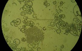 Wageningen University Blauwalgen onder microscoop (foto voor eenmalig gebruik)