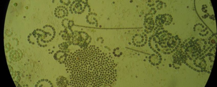Blauwalgen onder microscoop (foto voor eenmalig gebruik)