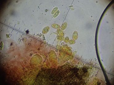 Eencellige ascosporen van de gewone stippelkorst