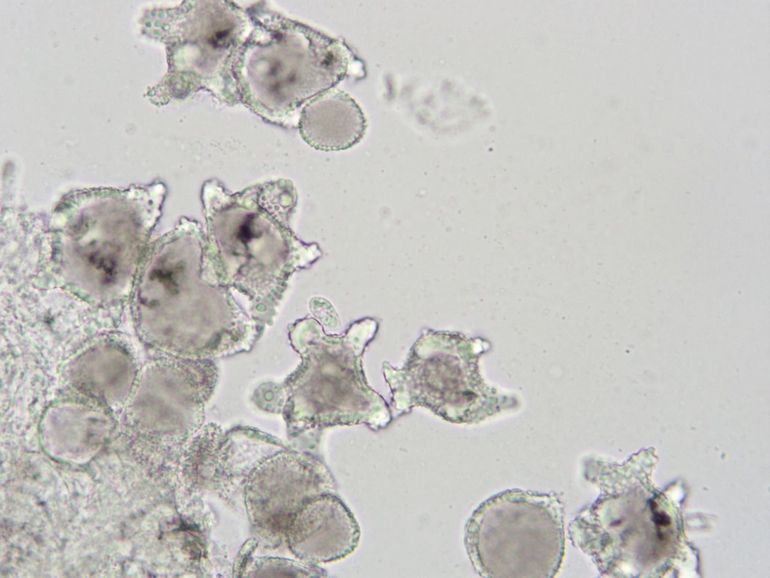 Microscoopfoto van enkele velumcellen. Bij Mycena amoena zijn deze cellen dikwandig en gelobd. Ze hebben een wrattig oppervlak en een gekleurde inhoud
