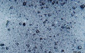 Microscopische opname van microplastics in tandpasta
Foto: Dantor. CC BY-SA 3.0-licentie
