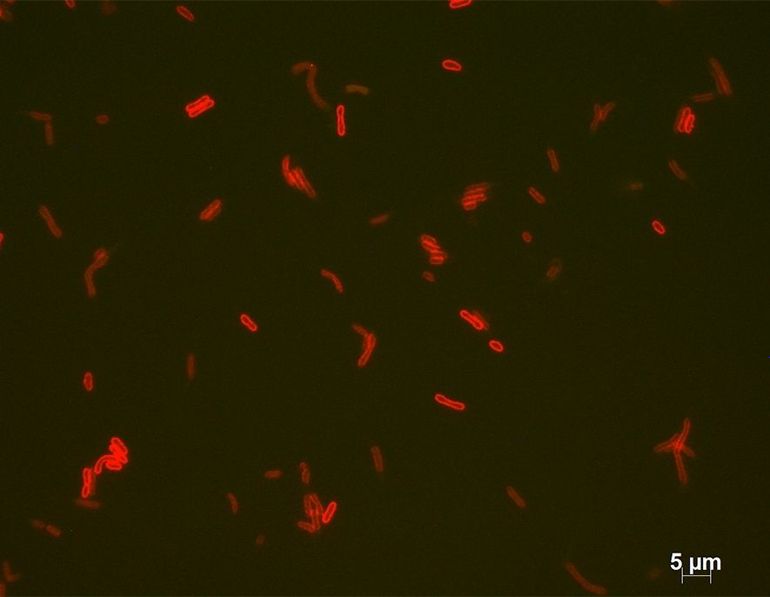 Fluorescent microscopy image of the bacteria Thermotoga maritima. The bacteria are stained to show their membrane in red. 5µm is 0,005 millimeter