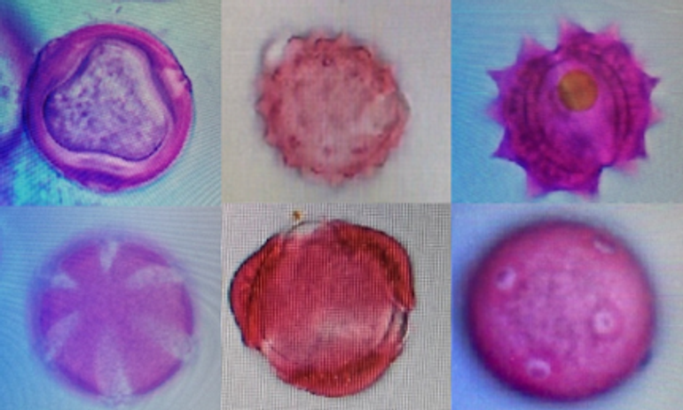 Stuifmeelkorrels onder de microscoop