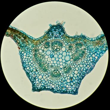 Cross section of leaf vein, Japanese willow