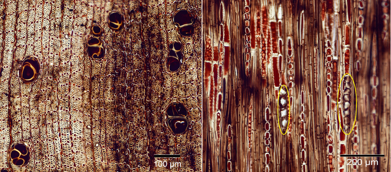 Van links naar rechts: lichtmicroscopische preparaten van de anatomie van een dwars- en overlangse doorsnede van het hout van de wettelijk beschermde ebbensoort Diospyros perrieri uit Madagaskar. De aanwezige calciumoxalaatkristallen zijn in geel omcirkeld