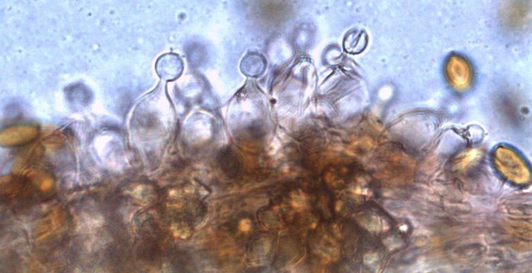 Kegelvormige cellen op lamelrand van Conocy-besoort
