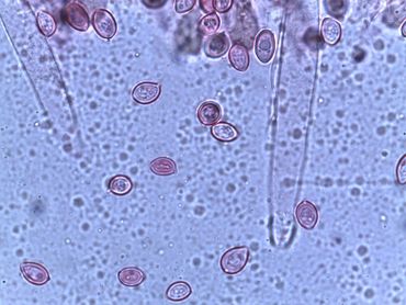 Microscopisch beeld van de sporen en lamelcystiden