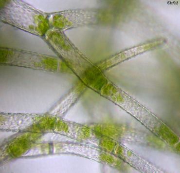 Microscopische opname van de pipet-achtige bladeren van Wolmos. De bolletjes groen zijn chloroplasten met chlorofyl die fotosynthese mogelijk maken