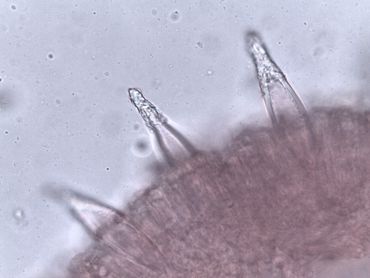 Lamel van Helmharpoenzwam met de metuloids op de lamelsnede
