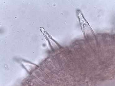 Lamel van Helmharpoenzwam met de metuloids op de lamelsnede