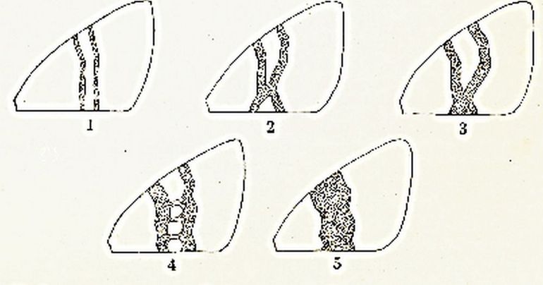 Variabiliteit bij spanners: 1. approximata-type, 2. tangens-type, 3. cotangenstype, 4 margaritata-type & 5. planicolor-type