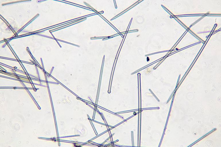 Spiculae, de naaldjes van het inwendige skelet, van de hierboven afgebeelde Vijgspons (microscopie-opname)