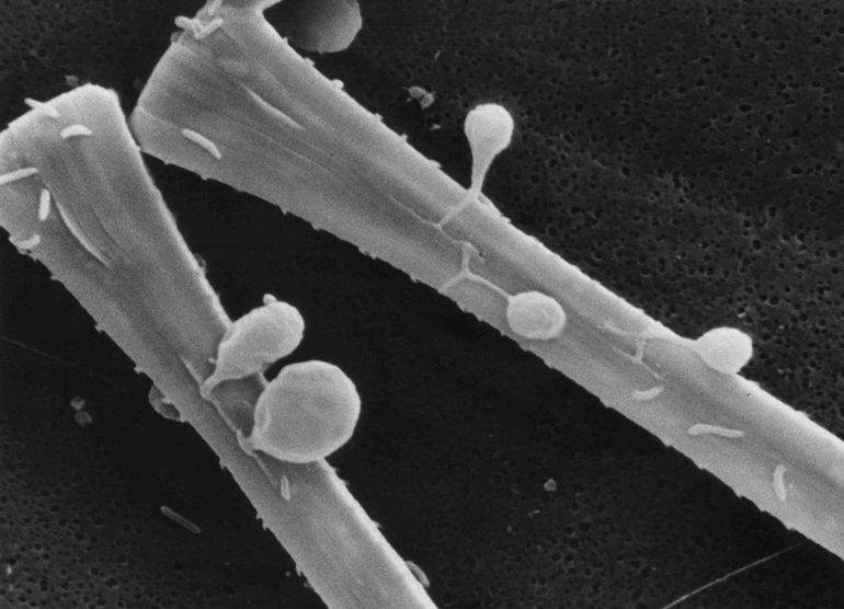 This freshwater diatom Asterionella suffers from a fungal infection. For some 40 years, researchers at the NIOO have been following the ups and downs surrounding the parasitic relationship, which started in the Maarseveense Plassen. Long-term measurements show that the infection rate varies between years, linked to temperatures. Below 3°C, the fungus goes dormant and only during really cold winters can Asterionella flourish. This provides insight into the effects of climate change on the food web in lakes