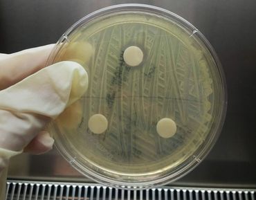 Result of bioassay test. Paper disks, loaded with different orchid extracts, were placed on top of bacterial strains growing on agar. Bacterial growth around the top disk was inhibited