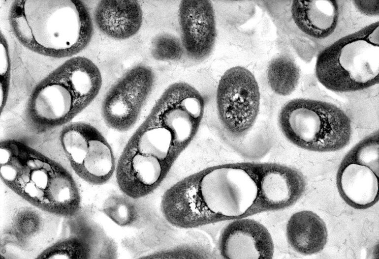 Some bacteria, like the Cupriavidus necator pictured here, can accumulate large amounts of internal storage compounds. Here the large white bodies inside the cells are polyhydroxyalkanoate storage accounting for 37 percent of the cell mass