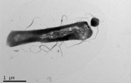 Electron microscopie met parasitaire Ca. Nha. antarcticus: de kleine cirkelvorm aan de grotere gastheer, Hrr. lacusprofundi. Beeld: Joshua N Hamm