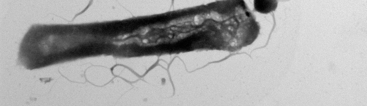 Electron microscopie met parasitaire Ca. Nha. antarcticus: de kleine cirkelvorm aan de grotere gastheer, Hrr. lacusprofundi. Beeld: Joshua N Hamm