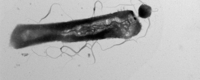 Electron microscopie met parasitaire Ca. Nha. antarcticus: de kleine cirkelvorm aan de grotere gastheer, Hrr. lacusprofundi. Beeld: Joshua N Hamm