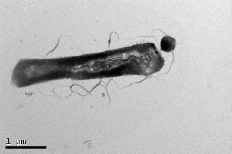 Opname van elektronenmicroscopie met parasitaire Ca. Nha. antarcticus: de kleine cirkelvorm aan de grotere gastheer, Hrr. lacusprofundi
