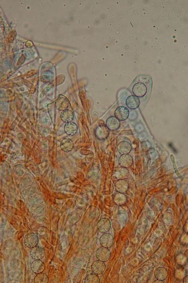 Asci met sporen van de Kalkgraslandwimperzwam