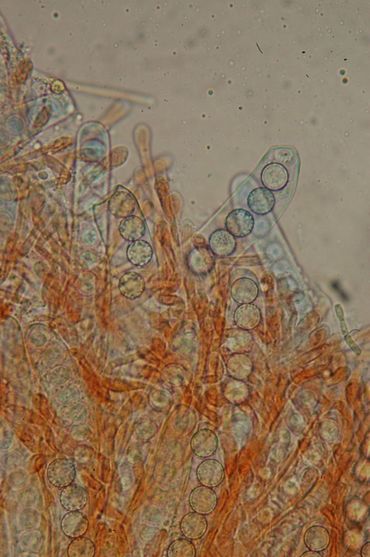 Asci met sporen van de Kalkgraslandwimperzwam