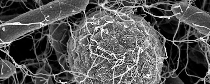 Spore omwikkeld door zweepdraden van omringende bacteriën