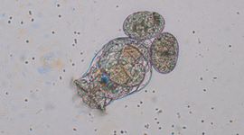 Raderdiertje Brachionus calyciflorus