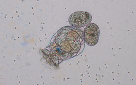 Raderdiertje Brachionus calyciflorus