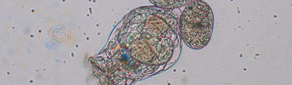 Raderdiertje Brachionus calyciflorus