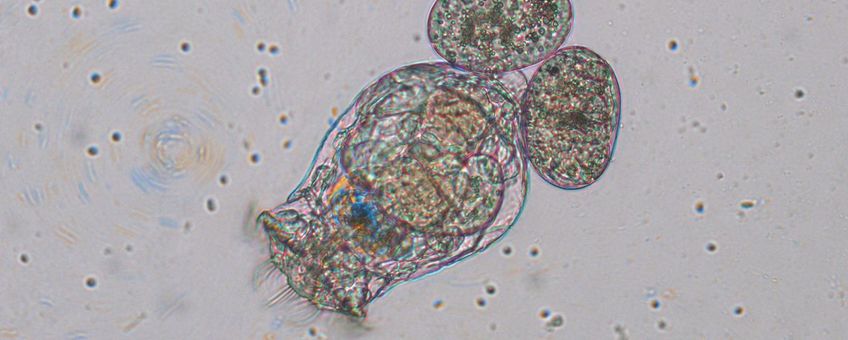 Raderdiertje Brachionus calyciflorus