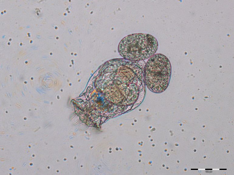 Raderdiertje, Brachionus calyciflorus