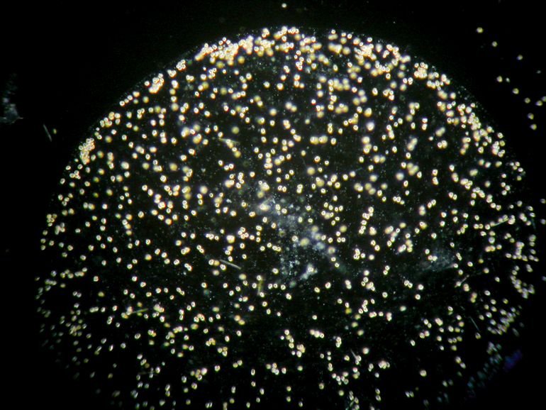 Microscopie opname van een kolonie schuimalgcellen. Ieder puntje is een cel, de ruimte tussen de cellen is de geleiachtige wand die o.a. gevormd wordt door suikerverbindingen