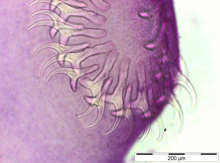 Head of a tapeworm Taenia species