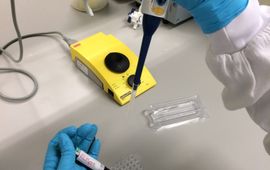 In de ELISpot test wordt het bloed van een mogelijke lymepatiënt onderzocht op activiteit van de afweercellen in het laboratorium.